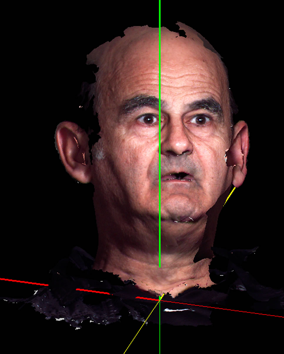 Stelarc — <em>Zombie</em> (2003)
